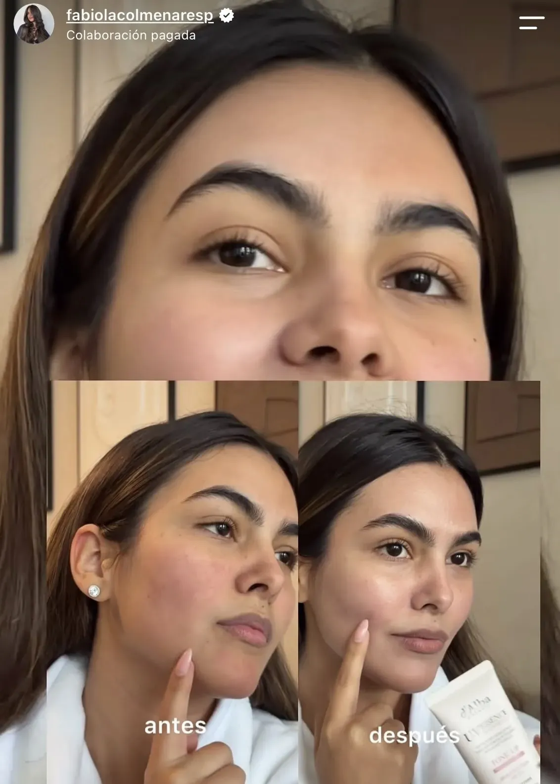 Fabiola en una comparación antes y después usando productos de d'Alba